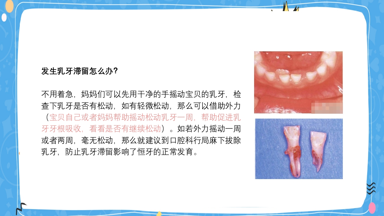 婴幼儿口腔保健知识PPT课件21