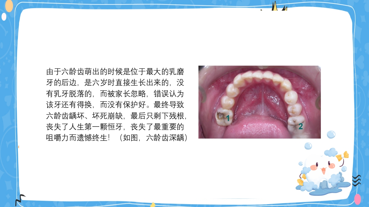 婴幼儿口腔保健知识PPT课件23