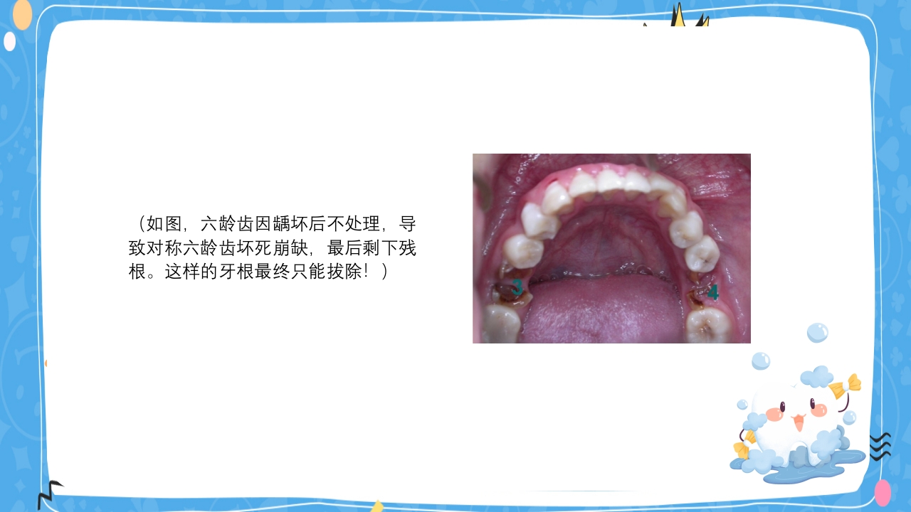 婴幼儿口腔保健知识PPT课件24