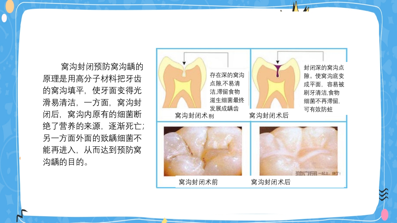 婴幼儿口腔保健知识PPT课件26
