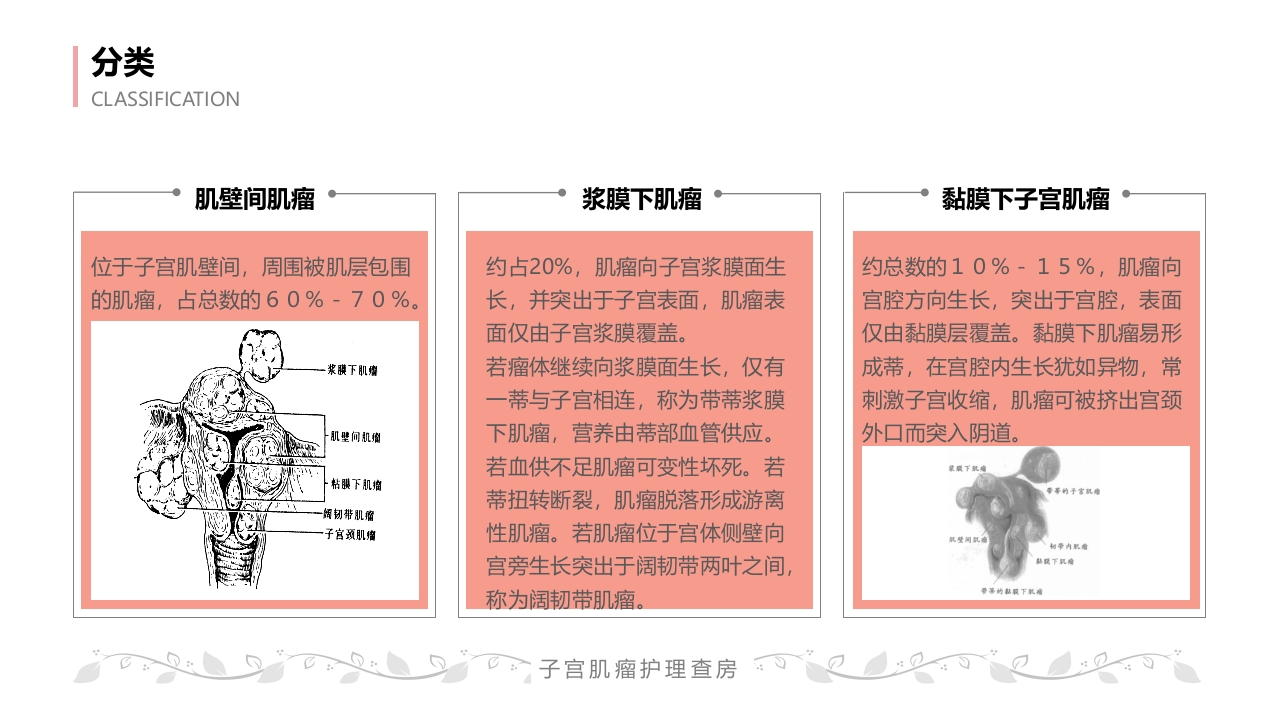 子宫肌瘤病人的护理查房PPT课件11