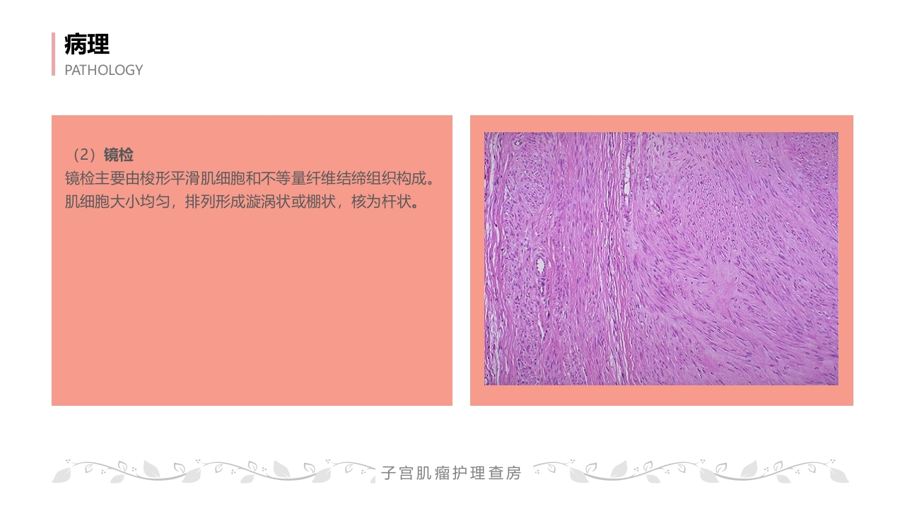 子宫肌瘤病人的护理查房PPT课件15