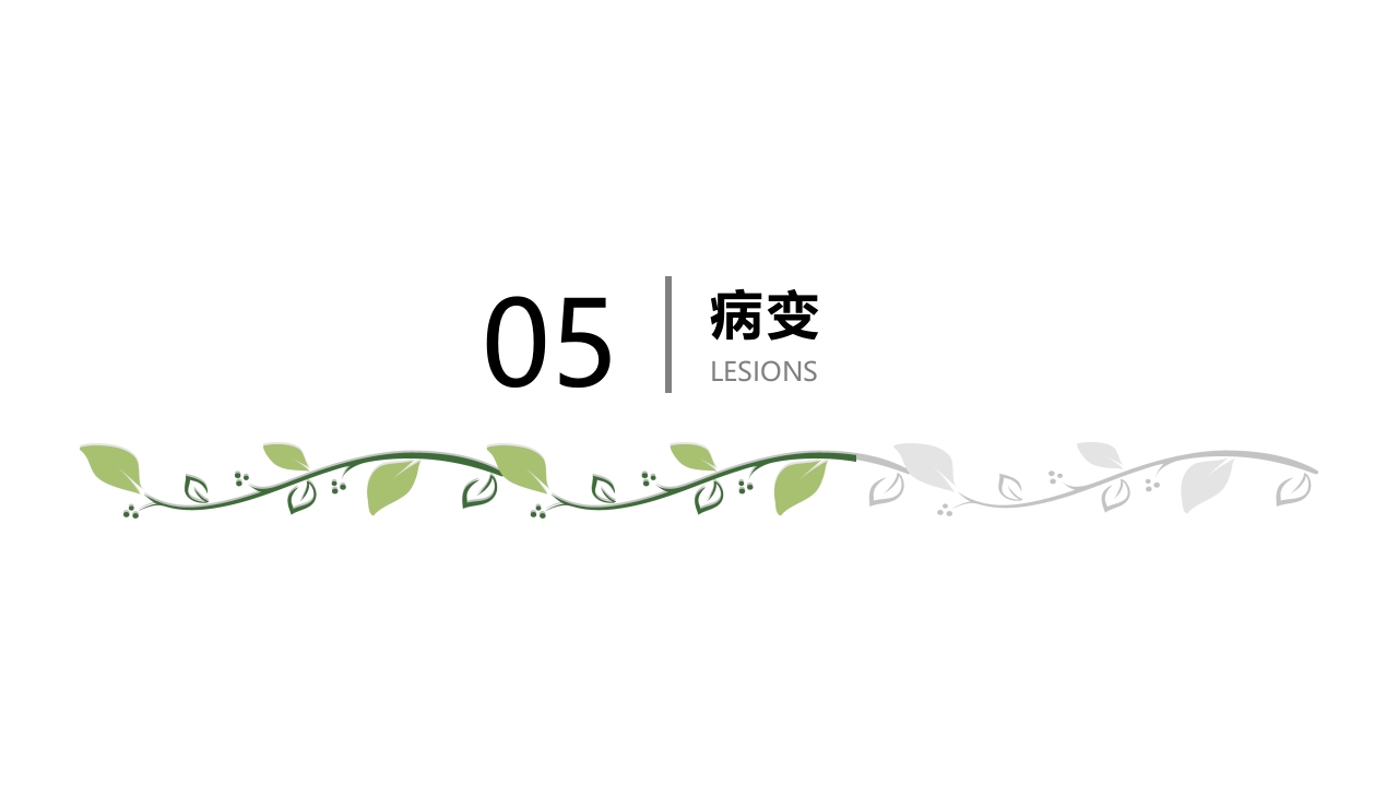 子宫肌瘤病人的护理查房PPT课件16