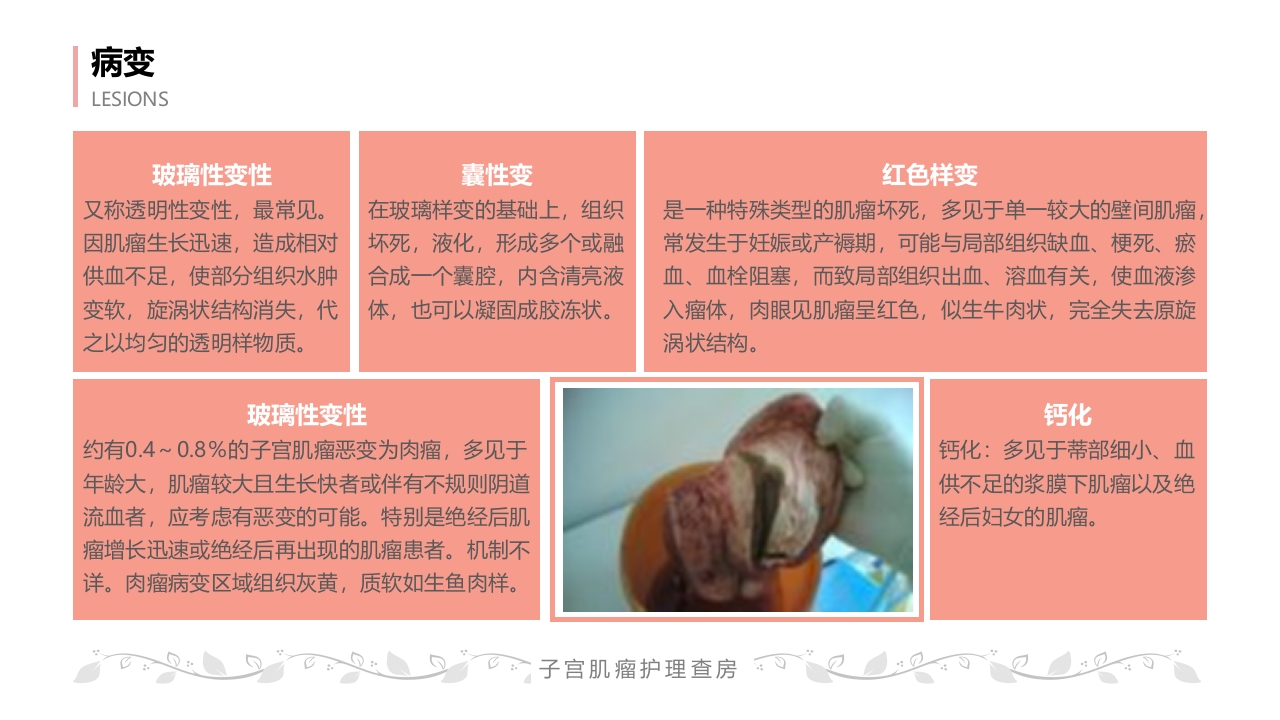 子宫肌瘤病人的护理查房PPT课件18