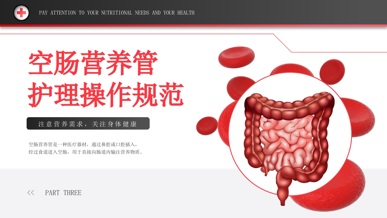 空肠营养管的护理PPT课件11