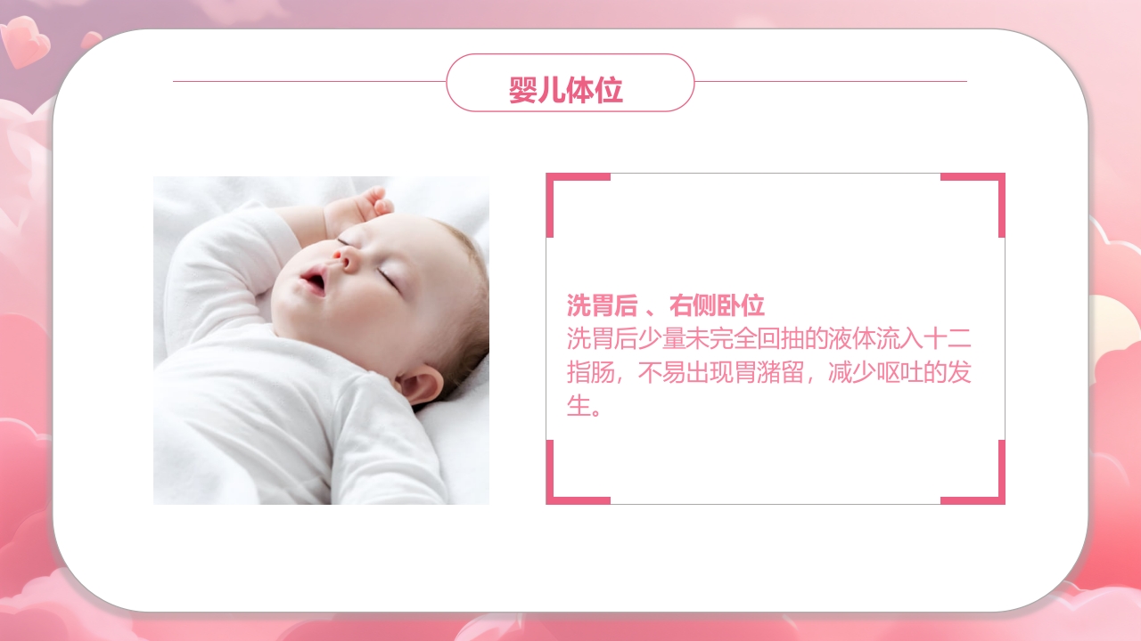 新生儿洗胃PPT课件10