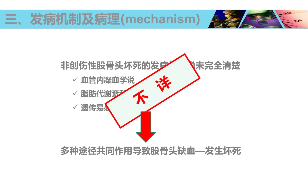 股骨头无菌性坏死PPT课件10
