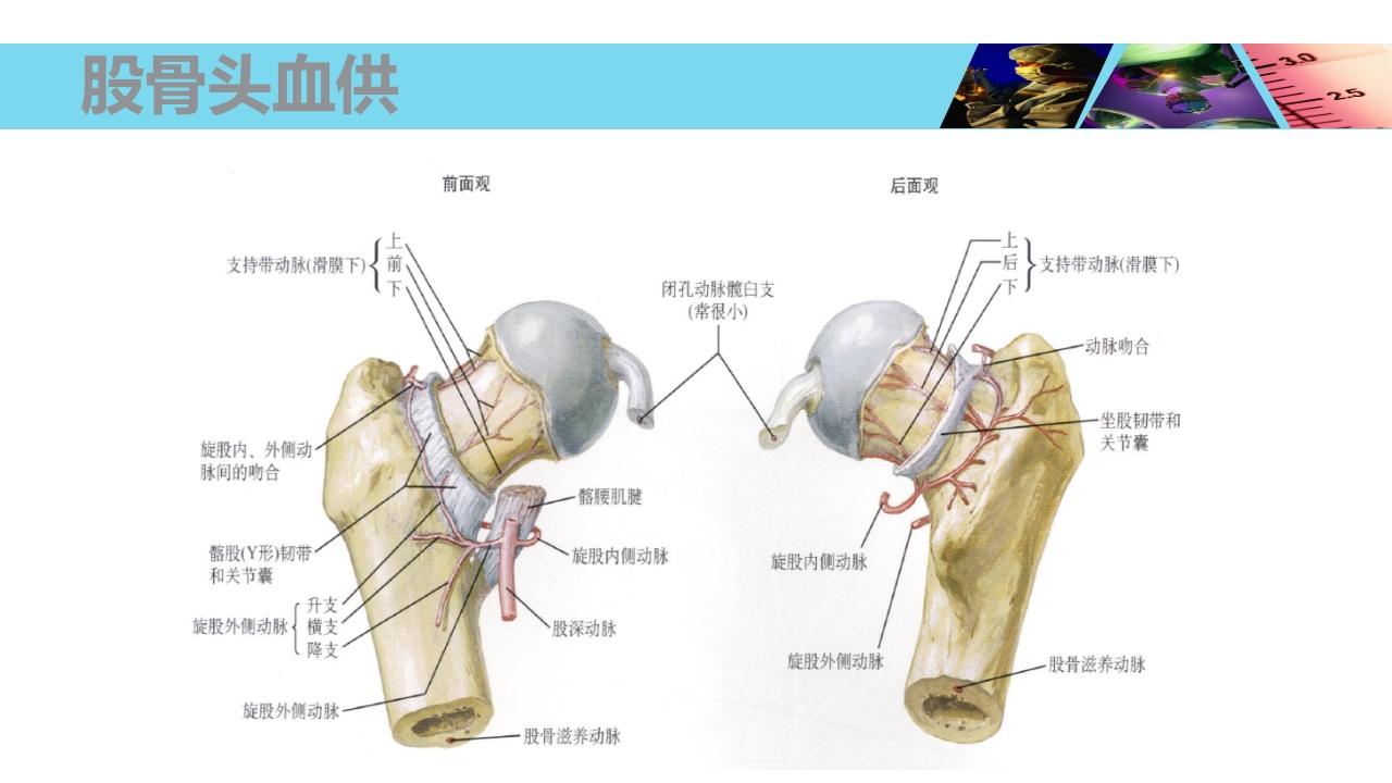 股骨头无菌性坏死PPT课件6