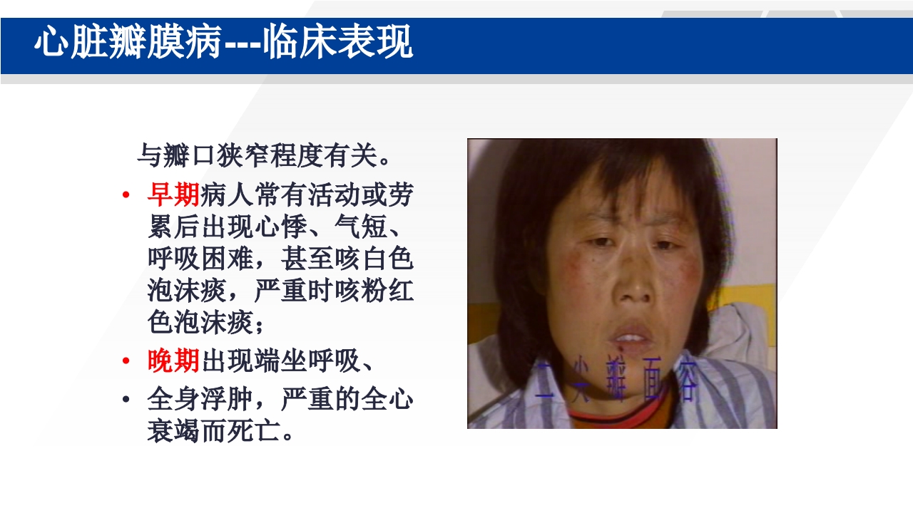 心脏瓣膜置换术后护理PPT课件14