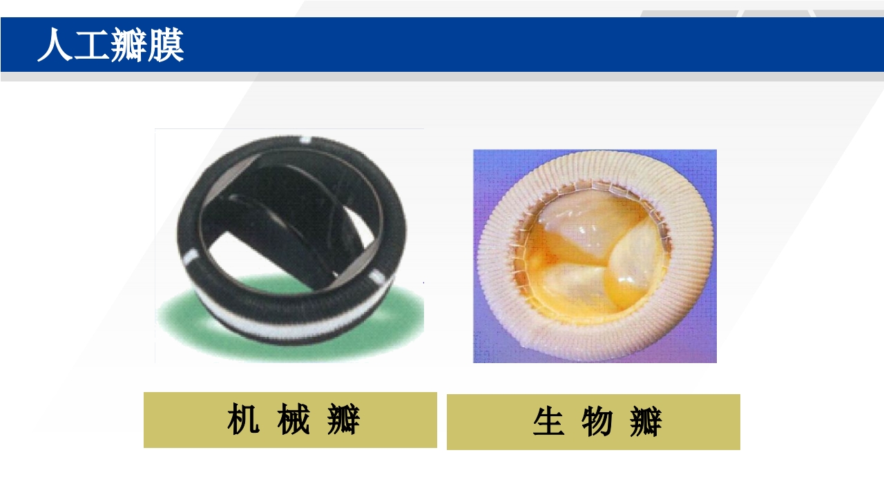 心脏瓣膜置换术后护理PPT课件20