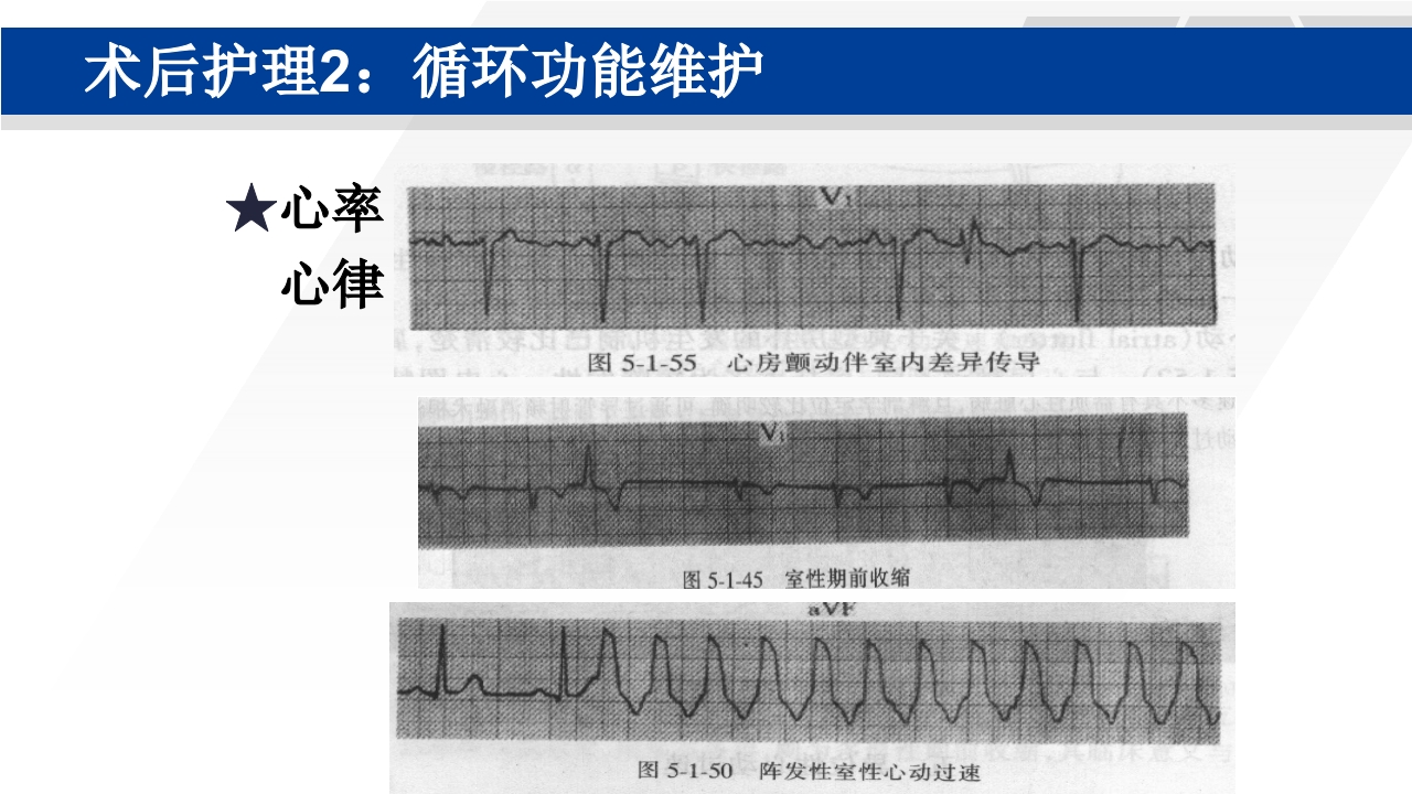 心脏瓣膜置换术后护理PPT课件37