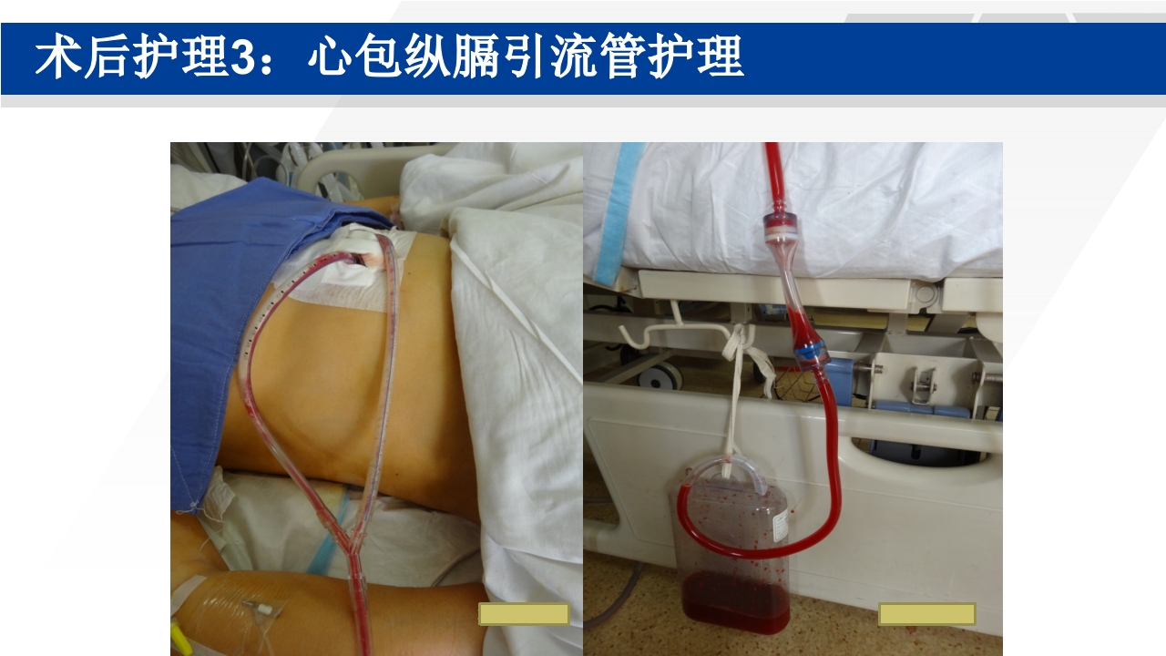 心脏瓣膜置换术后护理PPT课件40