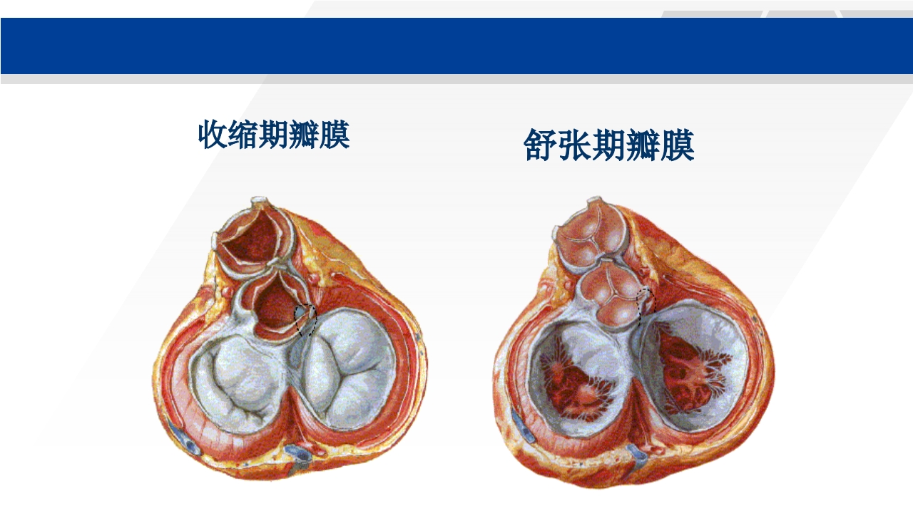 心脏瓣膜置换术后护理PPT课件6