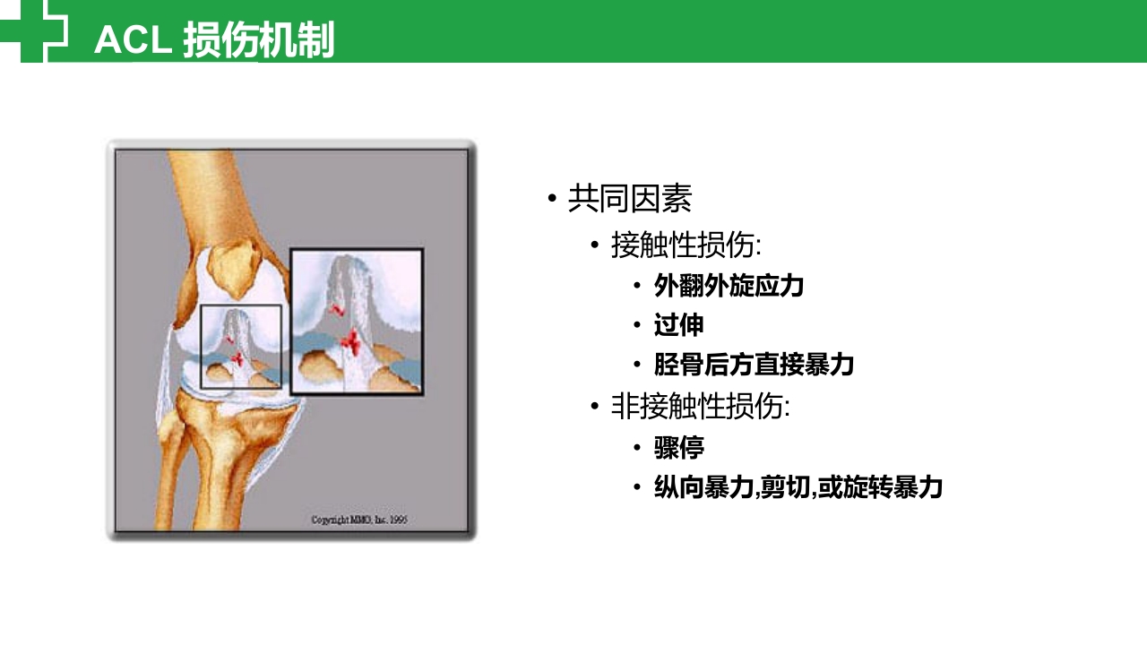 前交叉韧带损伤诊治护理查房PPT课件3