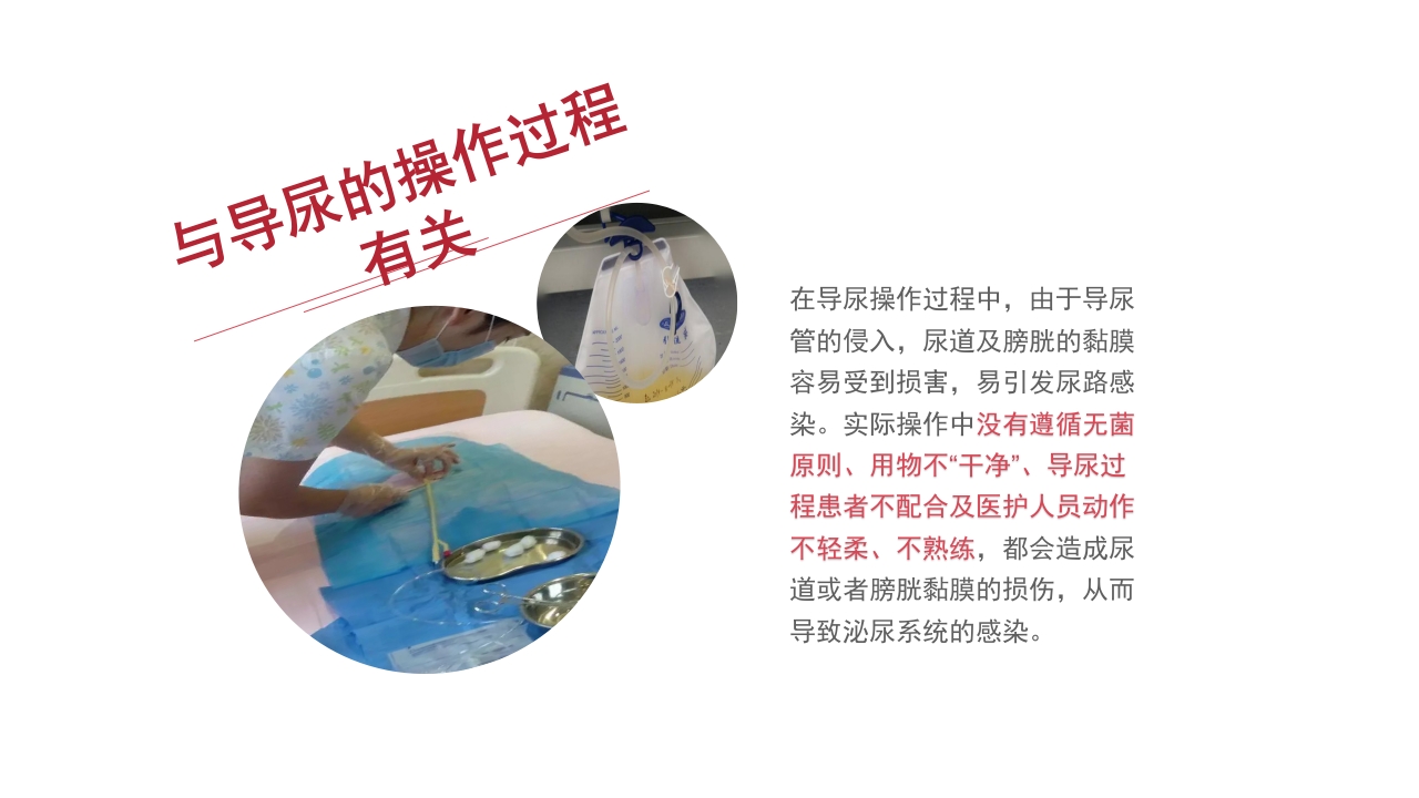 留置导尿致尿路感染的相关因素及护理分析PPT课件18