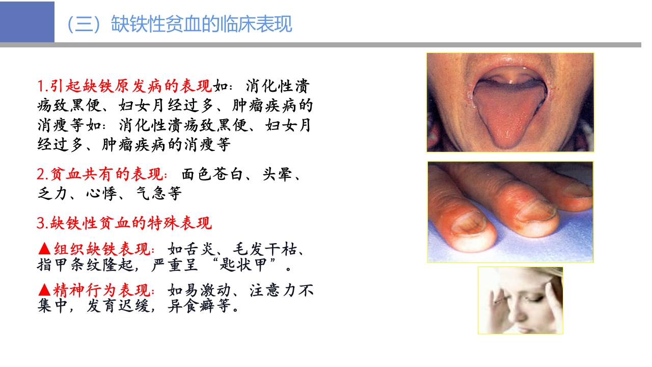 贫血病人的护理PPT课件11