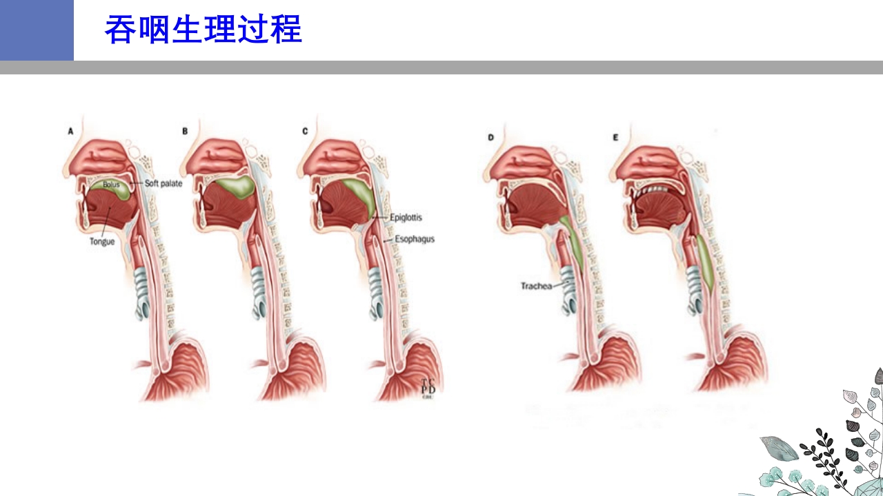 吞咽障碍PPT课件14