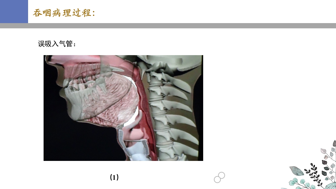 吞咽障碍PPT课件15