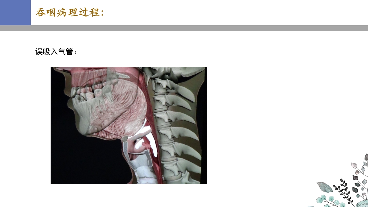 吞咽障碍PPT课件16