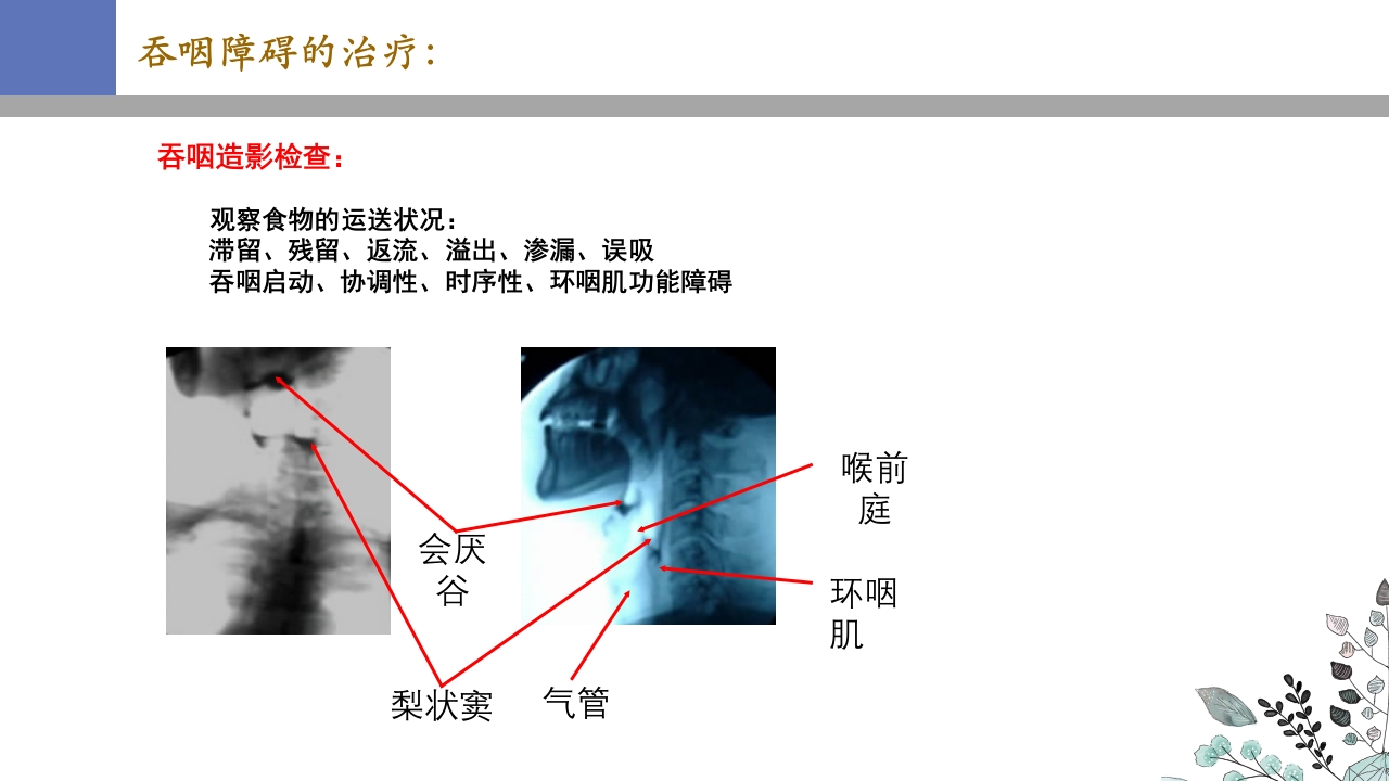 吞咽障碍PPT课件27