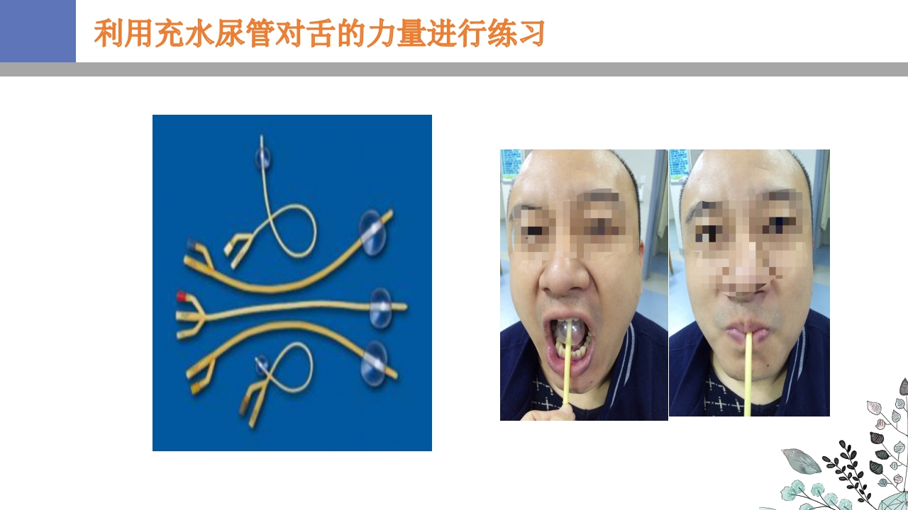 吞咽障碍PPT课件33