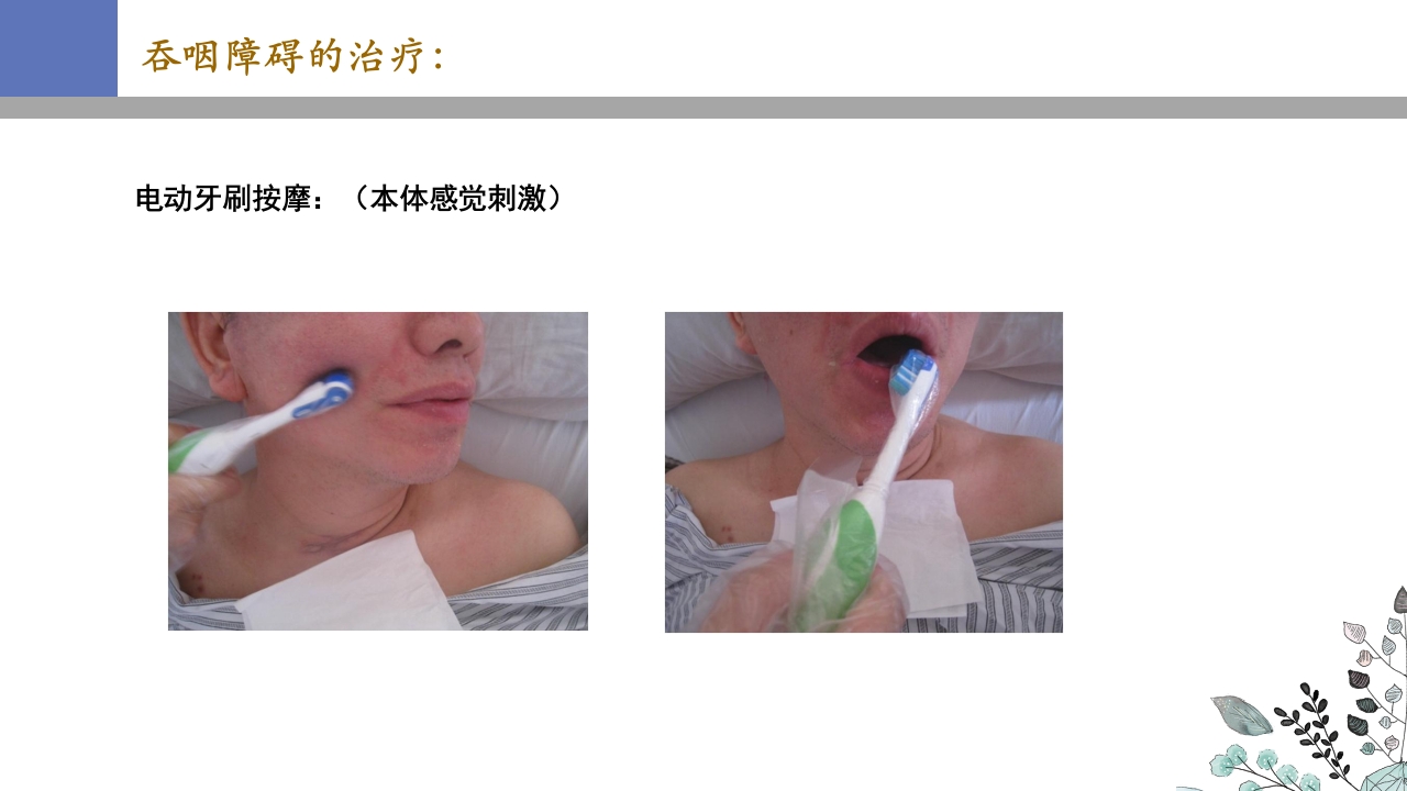 吞咽障碍PPT课件36