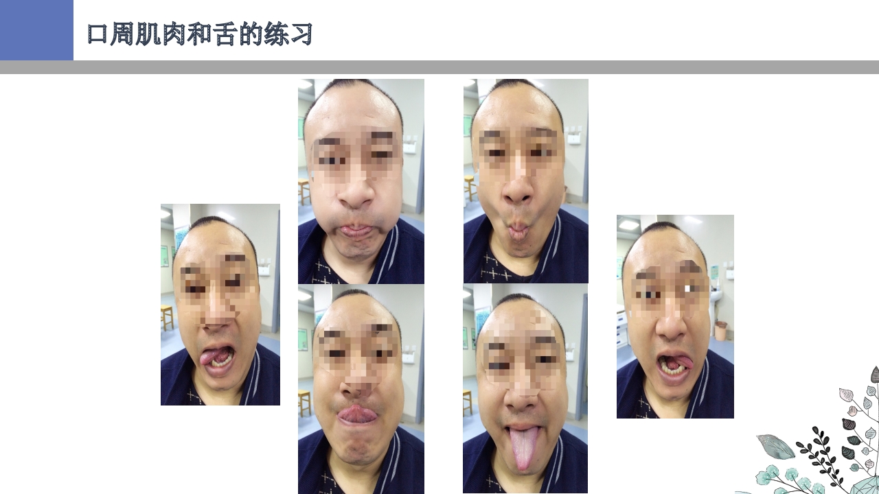 吞咽障碍PPT课件39