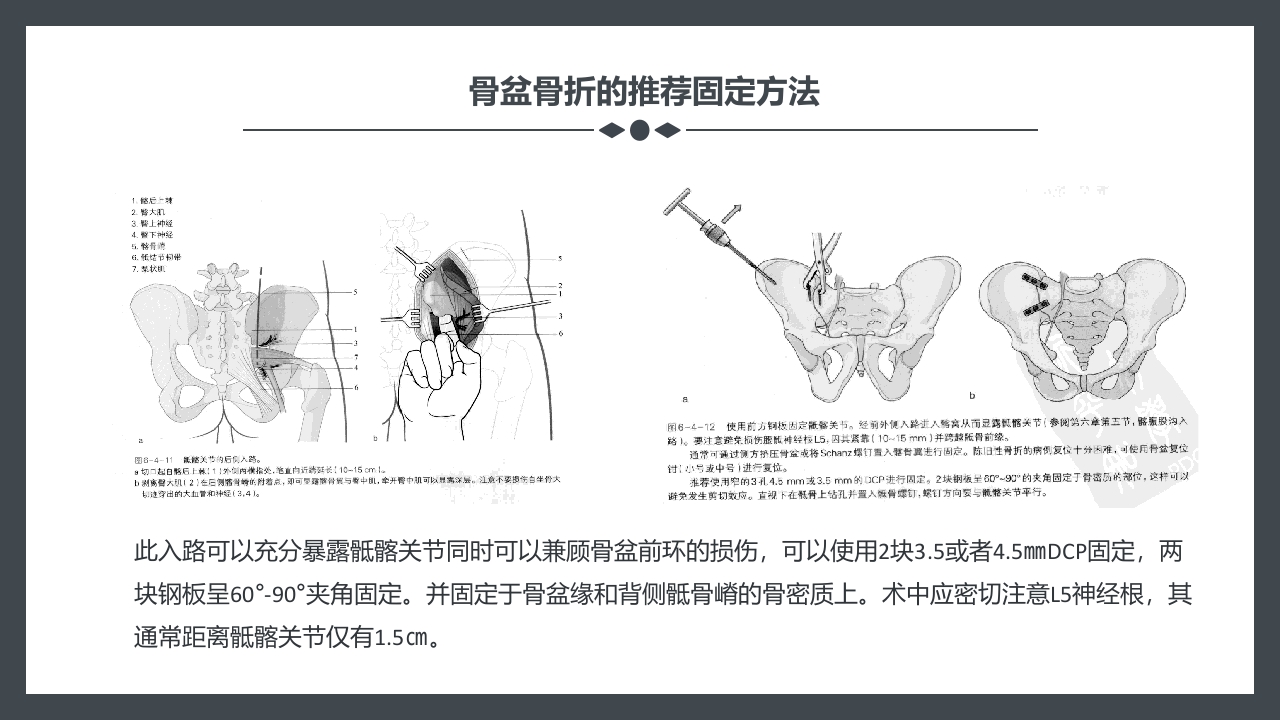 骨盆骨折护理查房PPT课件23