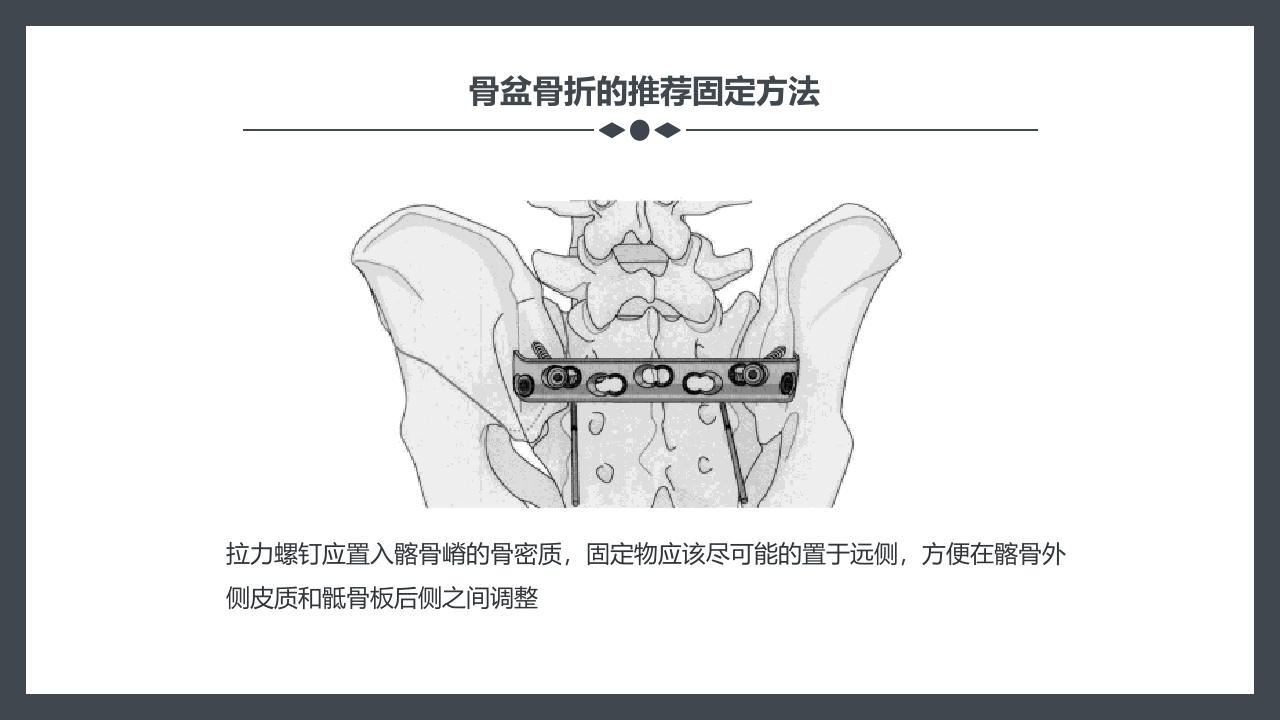 骨盆骨折护理查房PPT课件25