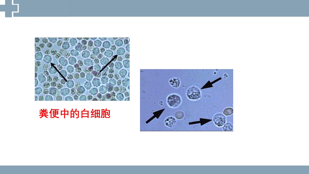 粪便检查PPT课件26