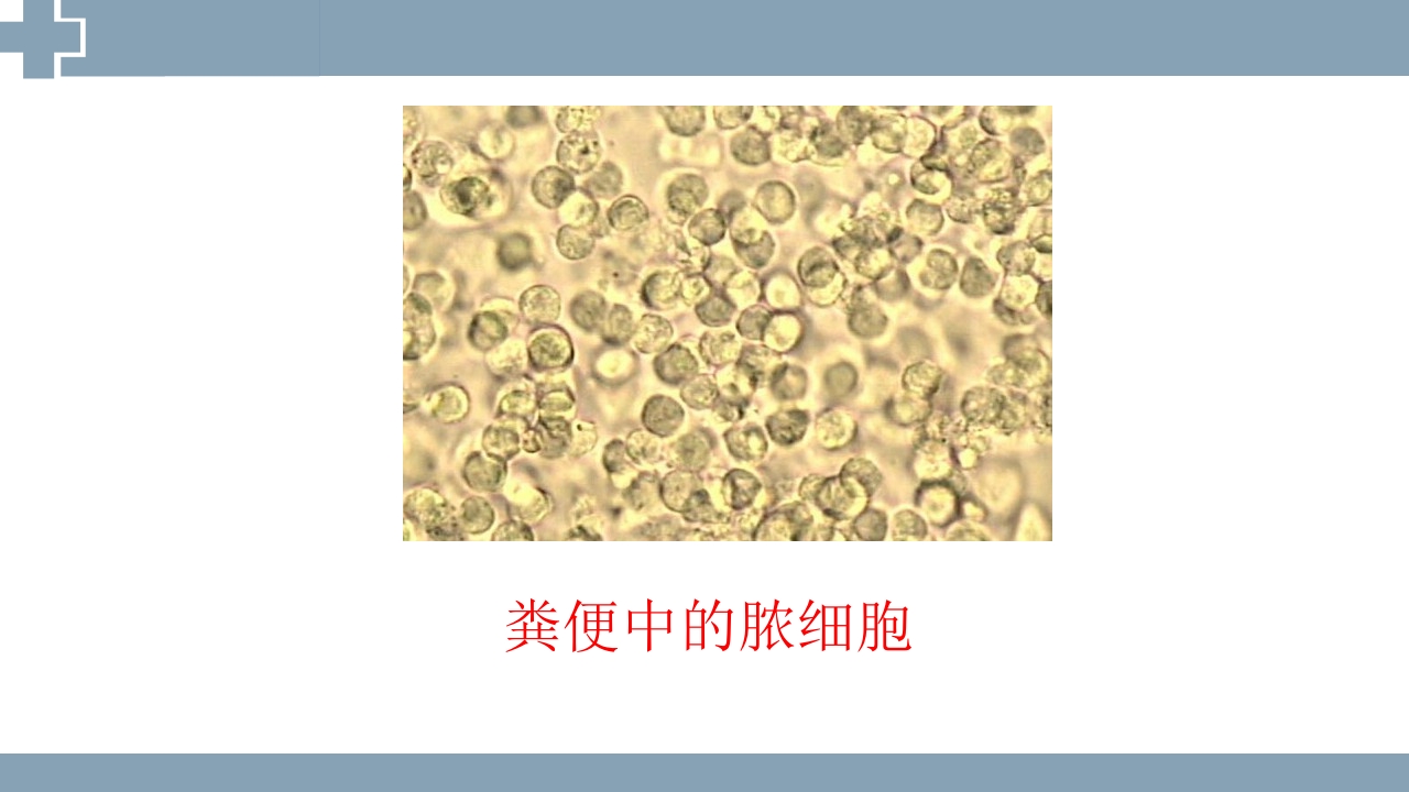 粪便检查PPT课件27