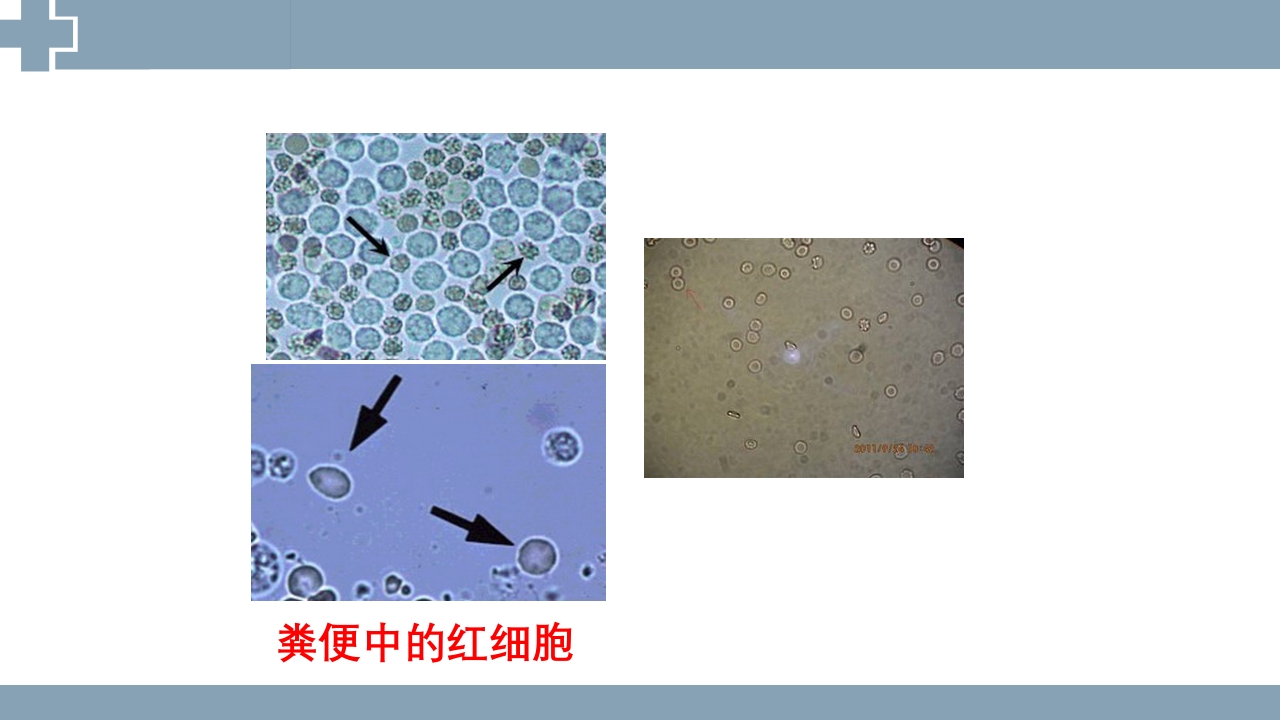 粪便检查PPT课件30