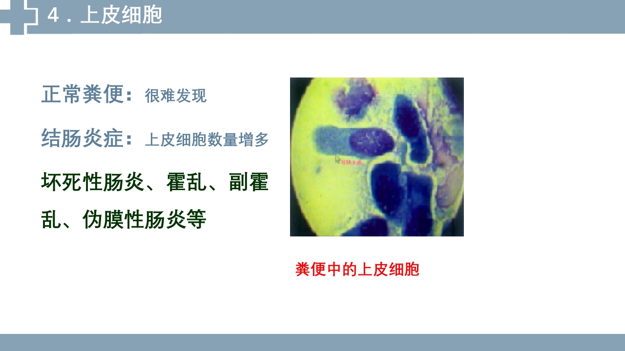 粪便检查PPT课件32