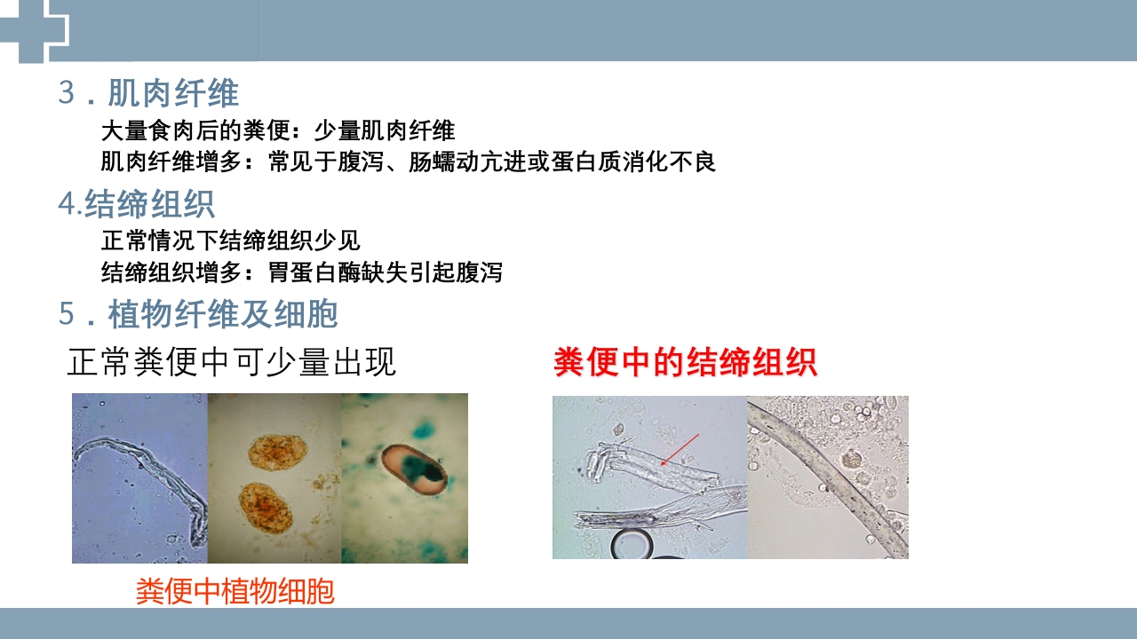 粪便检查PPT课件36