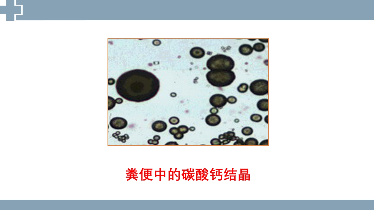 粪便检查PPT课件39