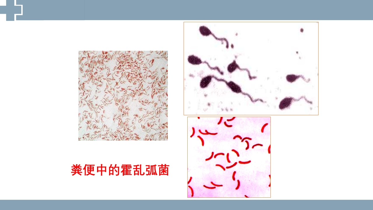 粪便检查PPT课件44