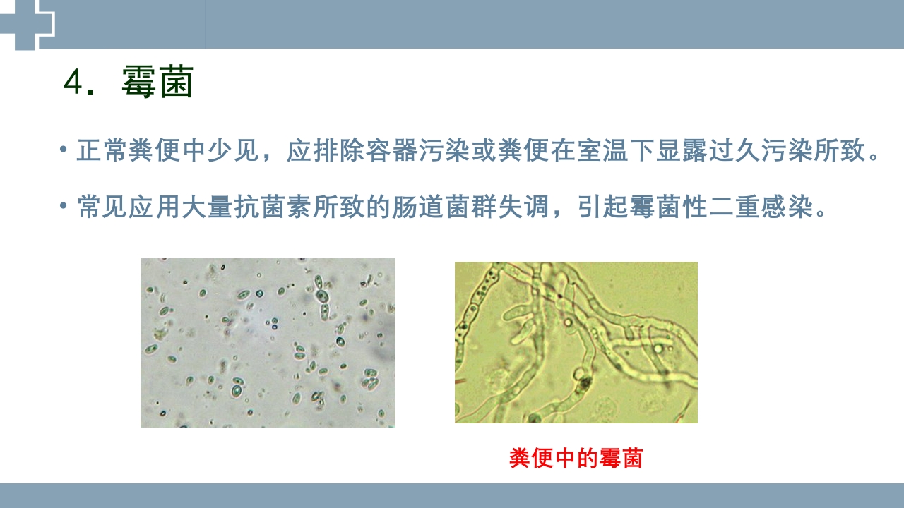 粪便检查PPT课件46