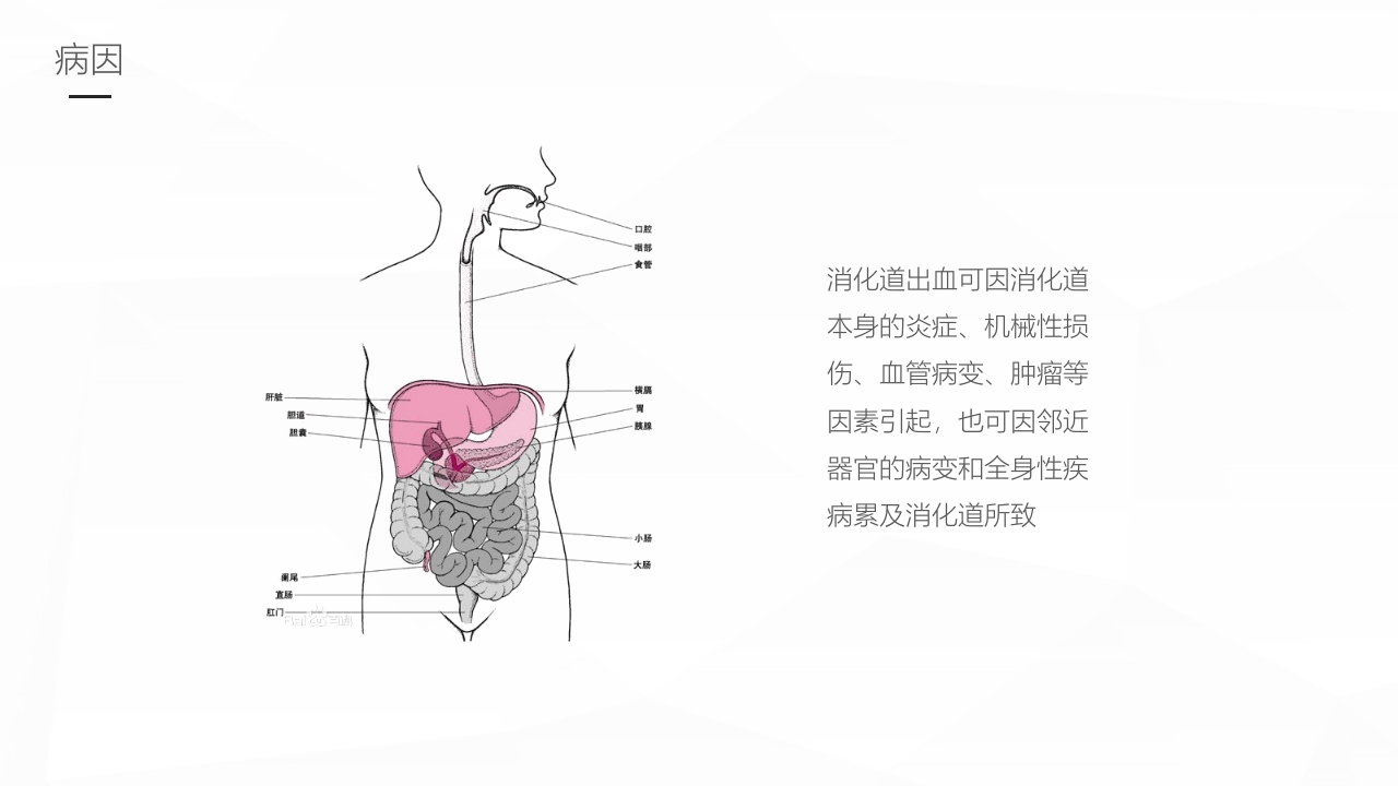 消化道出血护理业务学习PPT课件6