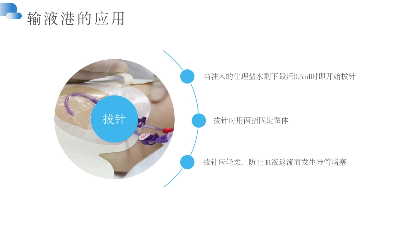 输液港维护及注意事项PPT课件16