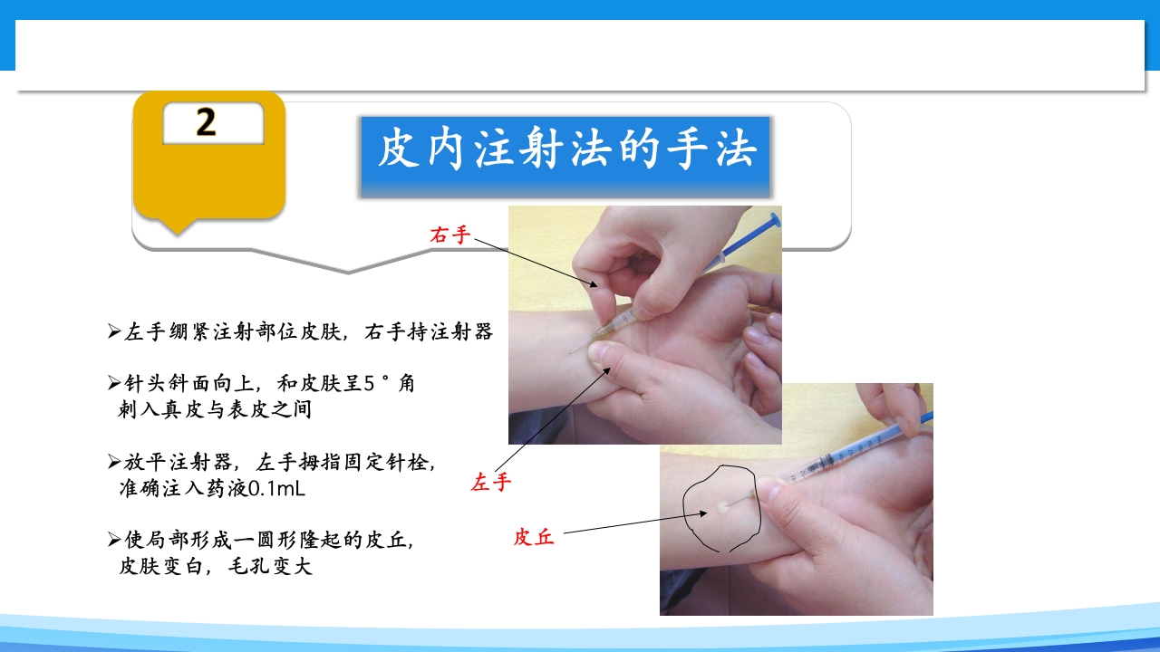 皮内注射PPT课件3
