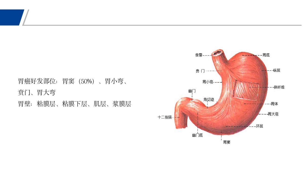 胃癌PPT课件8
