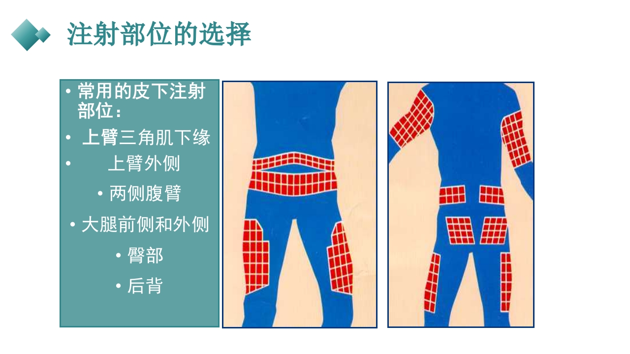 皮下、皮内、肌肉注射PPT课件29