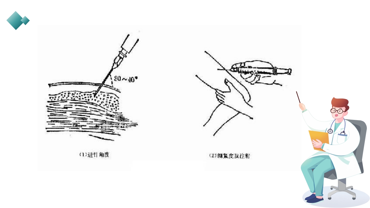 皮下、皮内、肌肉注射PPT课件30