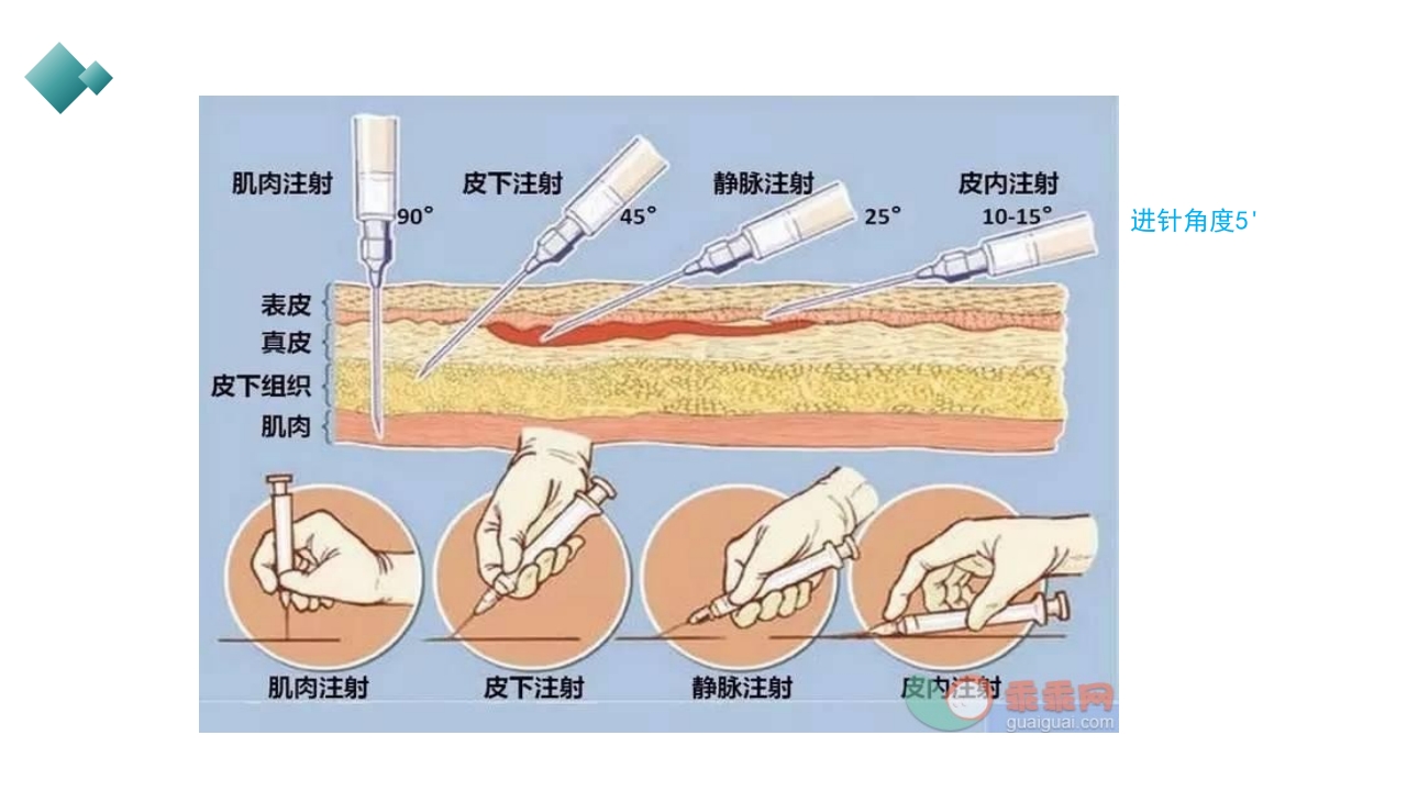 皮下、皮内、肌肉注射PPT课件34