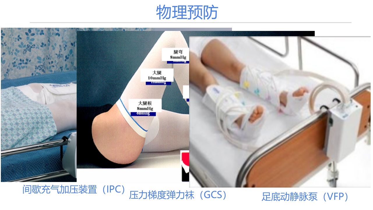 静脉血栓栓塞症(VTE)的诊断和治疗PPT课件42