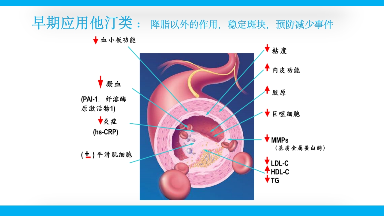 老年心绞痛PPT课件12