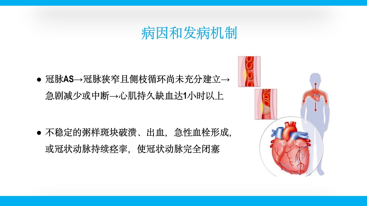 老年心绞痛PPT课件14