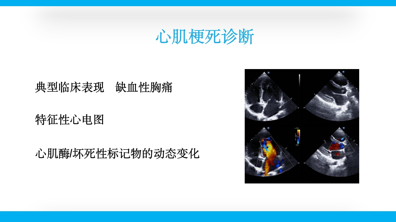 老年心绞痛PPT课件24