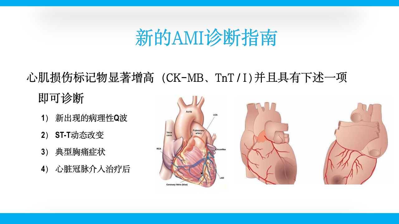 老年心绞痛PPT课件25