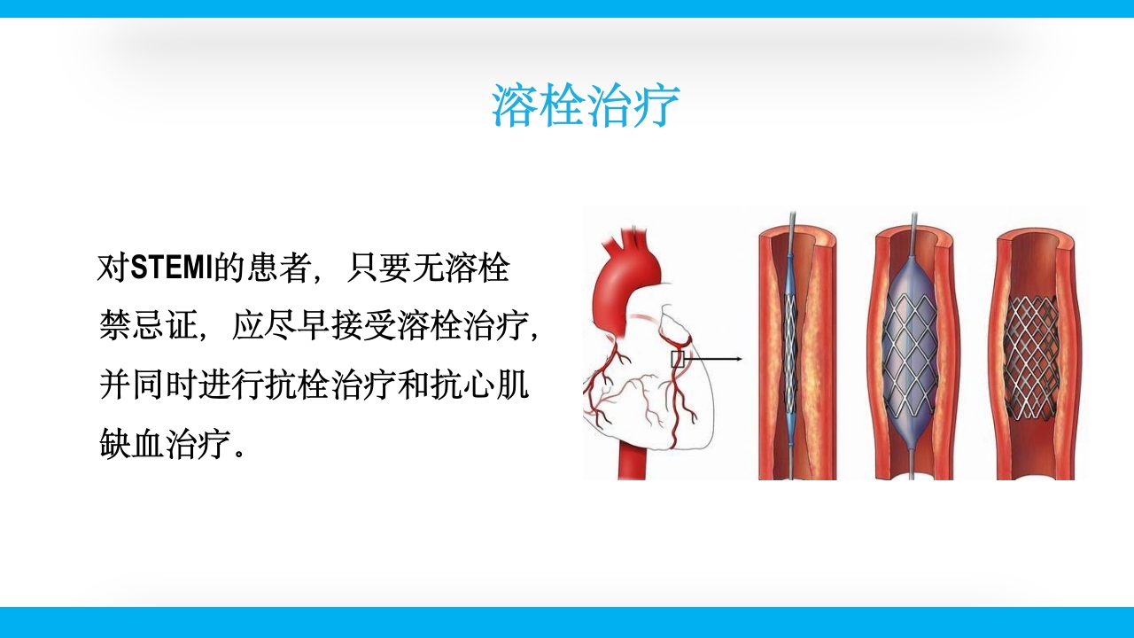 老年心绞痛PPT课件30